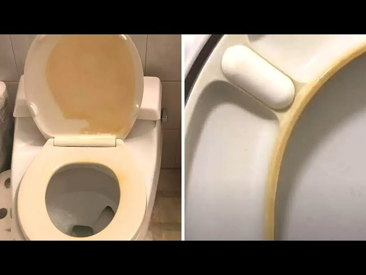 Le secret pour blanchir un abattant de WC jauni : 3 astuces - image 1